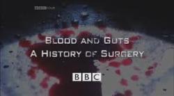 Blood and Guts: A History of Surgery thumbnail