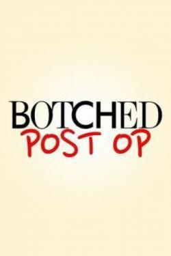 Botched: Post Op thumbnail